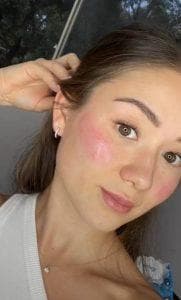 Cheek blush tattoo immediately after procedure