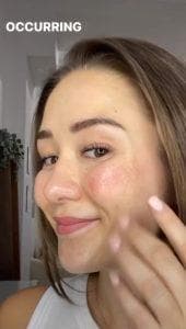 Cheek blush tattoo day 2 — side view