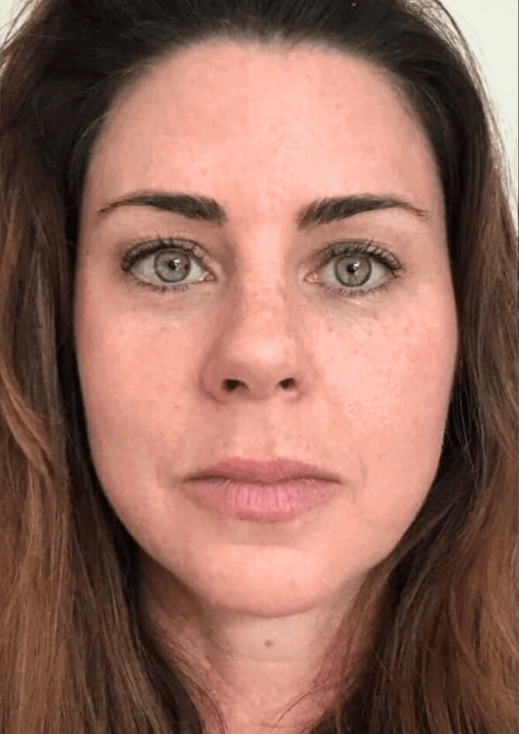Louisa's skin after the trial showing improved tone and radiance