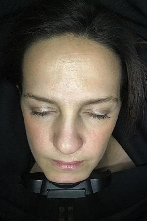 Jenna's Visia machine scan after eight weeks - smoother, more luminous