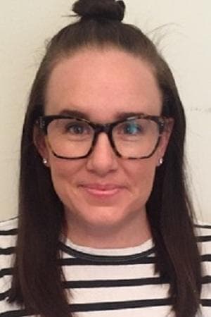 Amy's skin after eight weeks - improved texture and reduced pigmentation