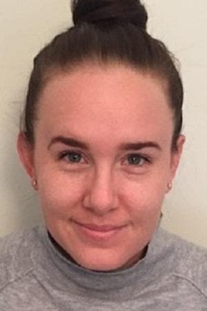 Amy's skin before the eight-week vitamin A trial
