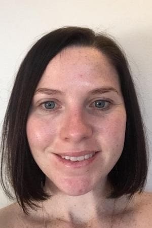 Kahli's skin after eight weeks - smoother fine lines around the eyes