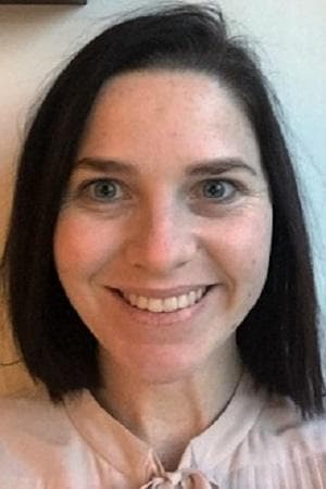 Kahli's skin before the eight-week vitamin A trial