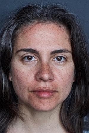 Katrina's skin before the eight-week vitamin A trial