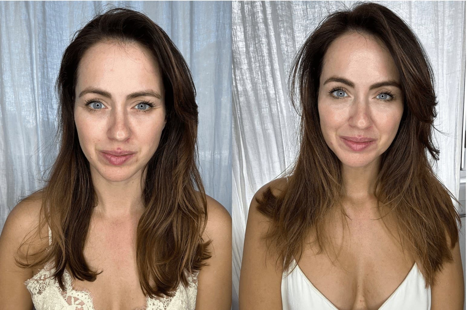 Sigourney's before and after results from at-home micro-infusion with Qure.