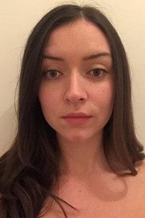 Allanah's skin after one week - reduced redness, smaller pores, glowy finish