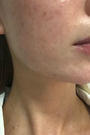 Gracie's skin after one week - calmer, more hydrated and less reactive