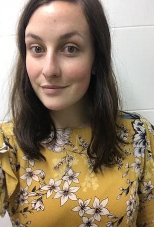 Madeline's skin after one week - reduced redness and more even skin tone