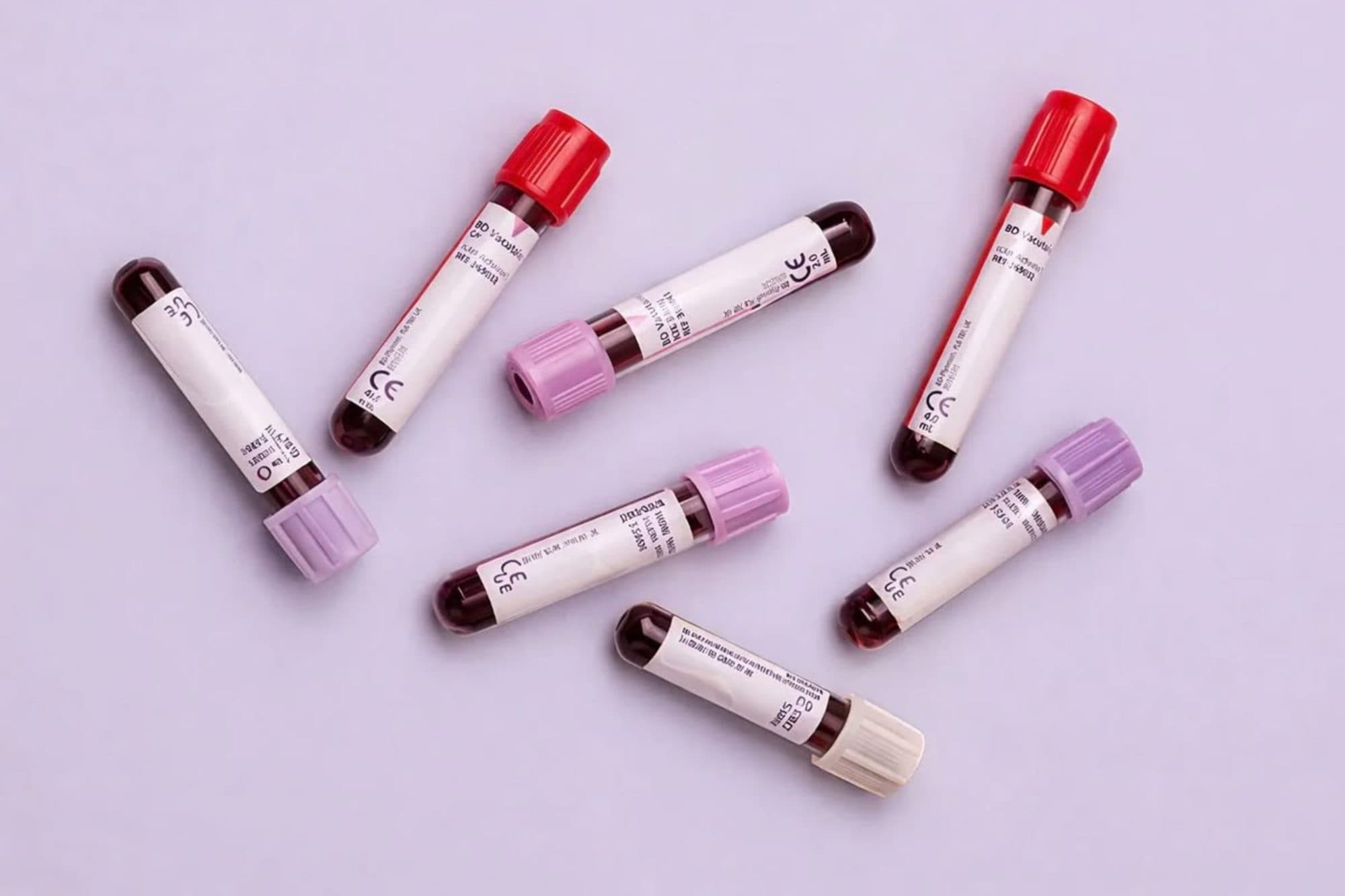 Blood collection tubes with red and lilac caps scattered on a pale lilac background