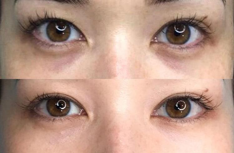 Permanentundereyeconcealer itsnowathing
