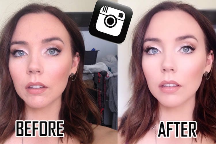 perfect365beforeandafter
