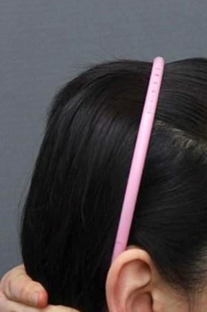 Before (Image: Item Plastic Surgery)