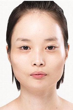 Before (Image: Item Plastic Surgery)