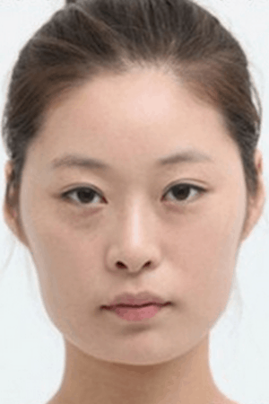 Before (Image: Item Plastic Surgery)
