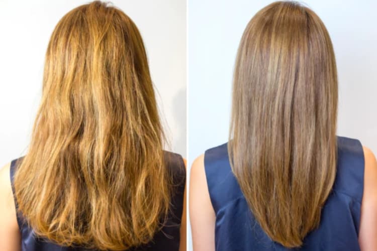 Before and after Epres