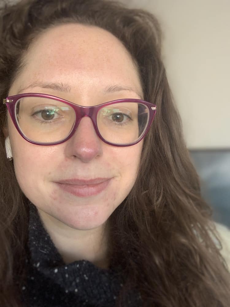 A pretty okay skin day. No raging spots, and flushing more pink than red