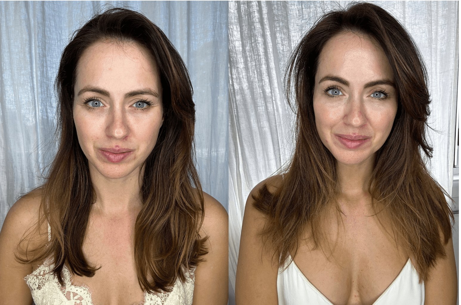 Before and after micro-infusion — visibly glowing skin by day three