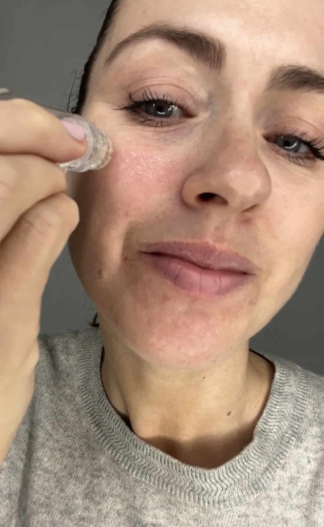The 50 percent overlap stamping technique across the cheek.