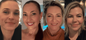 Système Bio+ Oil Serum before and after skin results