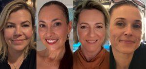Système Bio+ Oil Serum before and after skin results